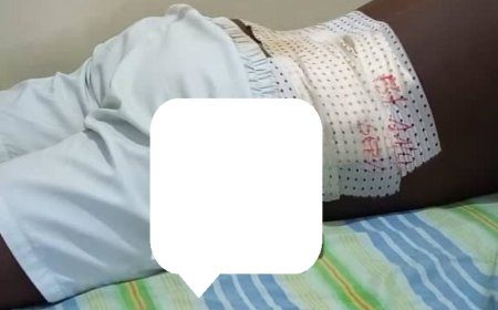 Rutshuru : MSF alerte sur l’afflux de blessés suite aux violences armées et la détérioration de la situation humanitaire à Nyanzale