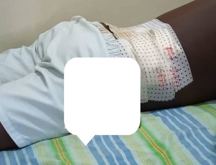 Rutshuru : MSF alerte sur l’afflux de blessés suite aux violences armées et la détérioration de la situation humanitaire à Nyanzale